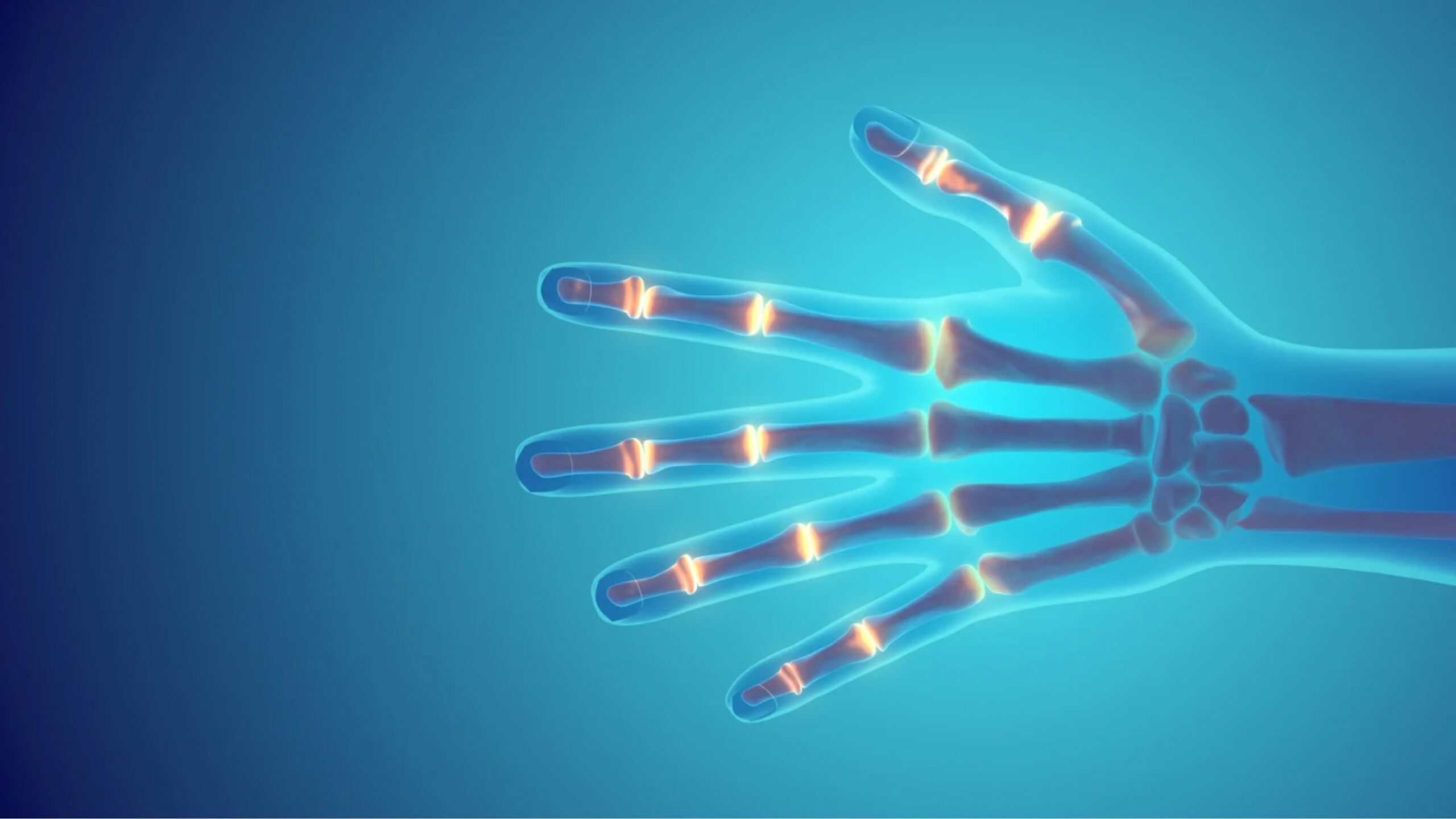 Physiotherapie bei rheumatoider Arthritis