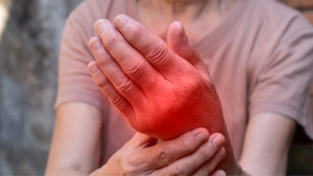 Hand, die eine Gelenksblockade aufweißt